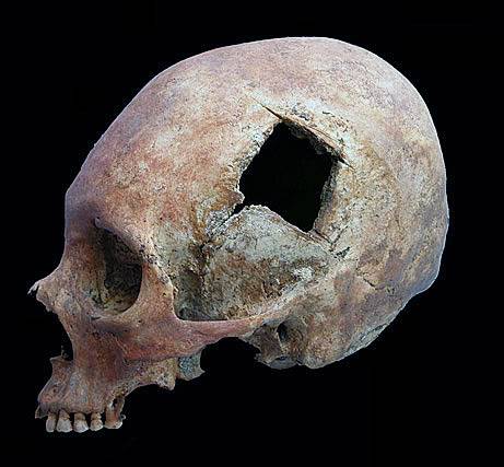 skull.jpg