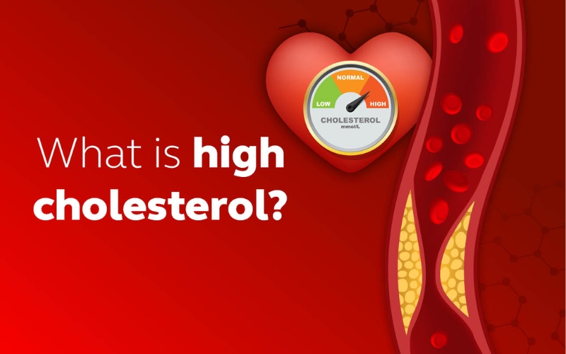 nguyen-nhan-tang-cholesterol