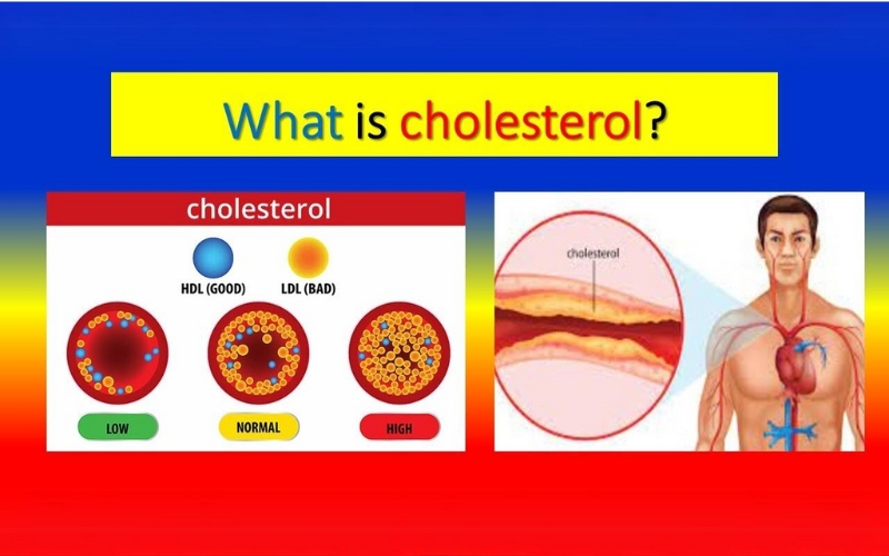 cholesterol-la-gi