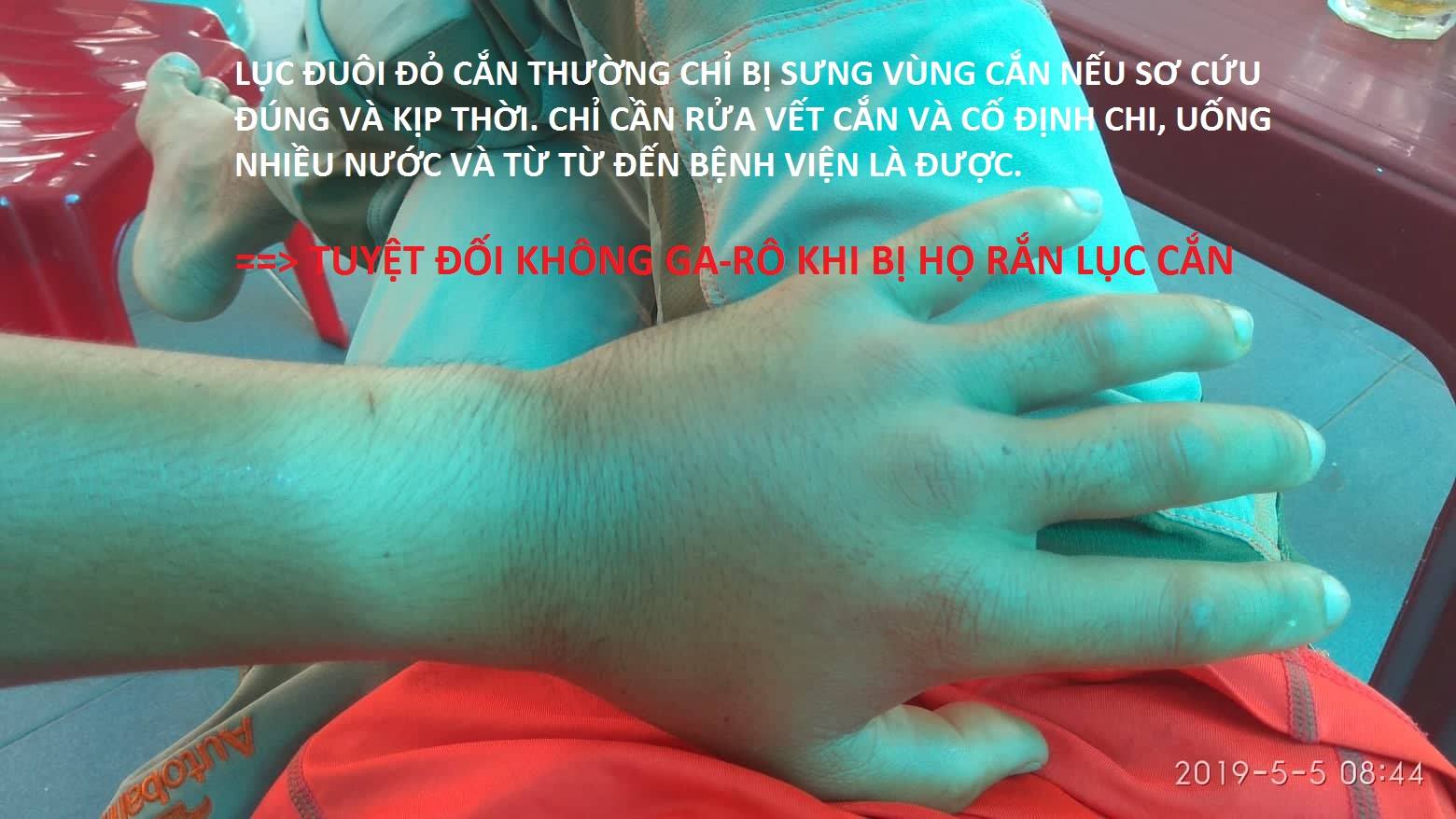 Rắn Lục Đuôi Đỏ Cắn