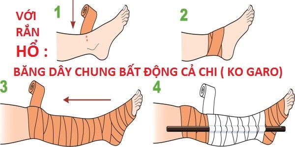 Cách xử lý khi rắn hổ cắn