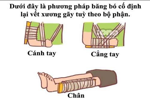 cach-so-cuu-khi-bi-gay-xuong-natuhai-ghi-dau-hanh-trinh.png