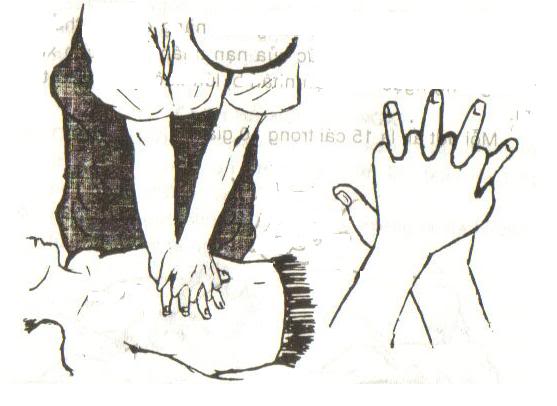 84vu4.jpg